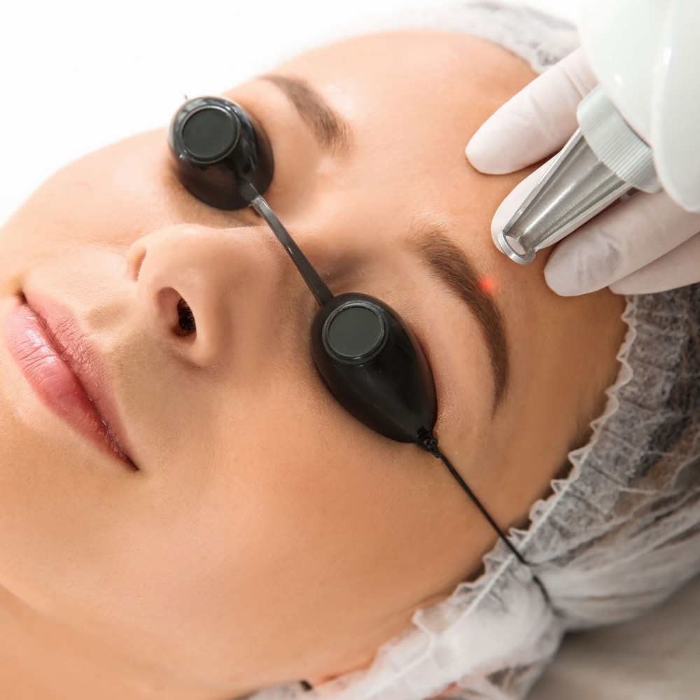 Como é o processo de Remoção de Micropigmentação